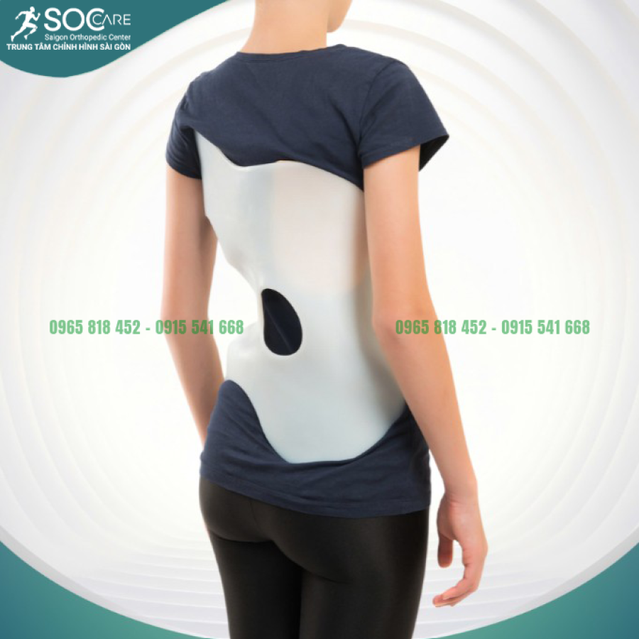 Áo chỉnh hình cột sống 3D