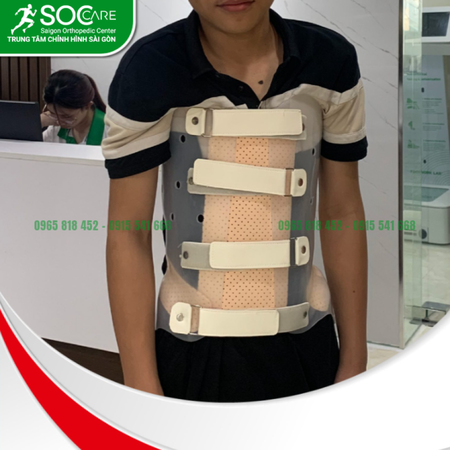 Áo chỉnh hình cột sống 2D