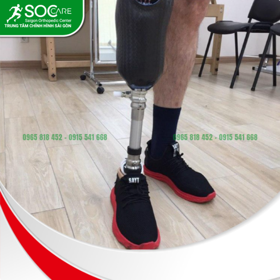Chân giả dưới gối cao cấp