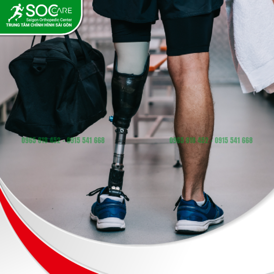 Chân giả dưới gối cao cấp