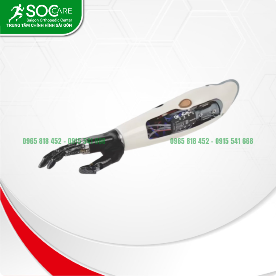 Tay giả chức năng điện