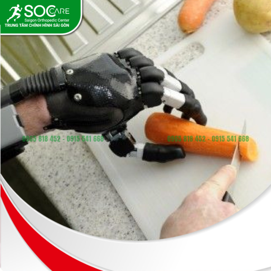 Tay giả chức năng điện