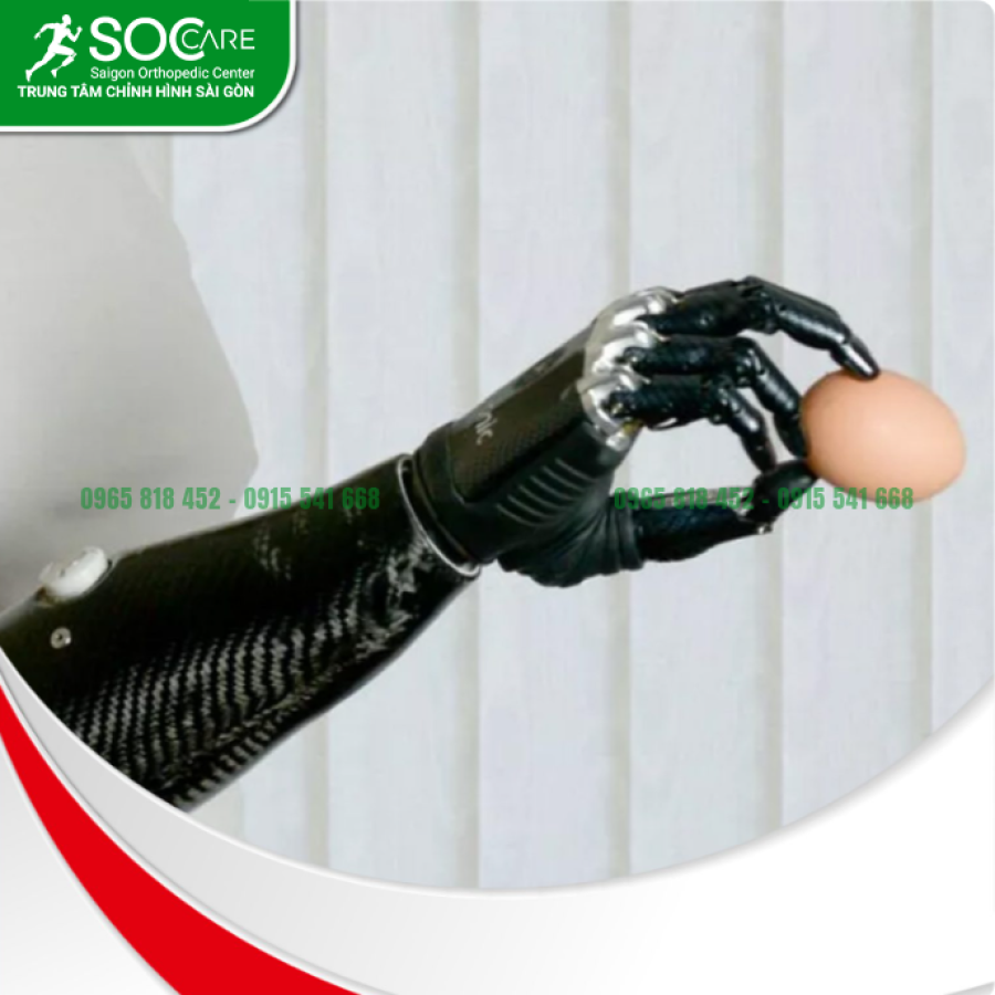 Tay giả chức năng điện