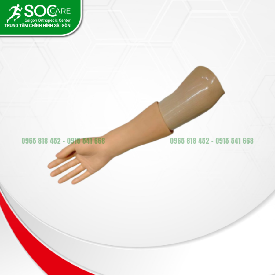 Tay giả dưới khuỷu