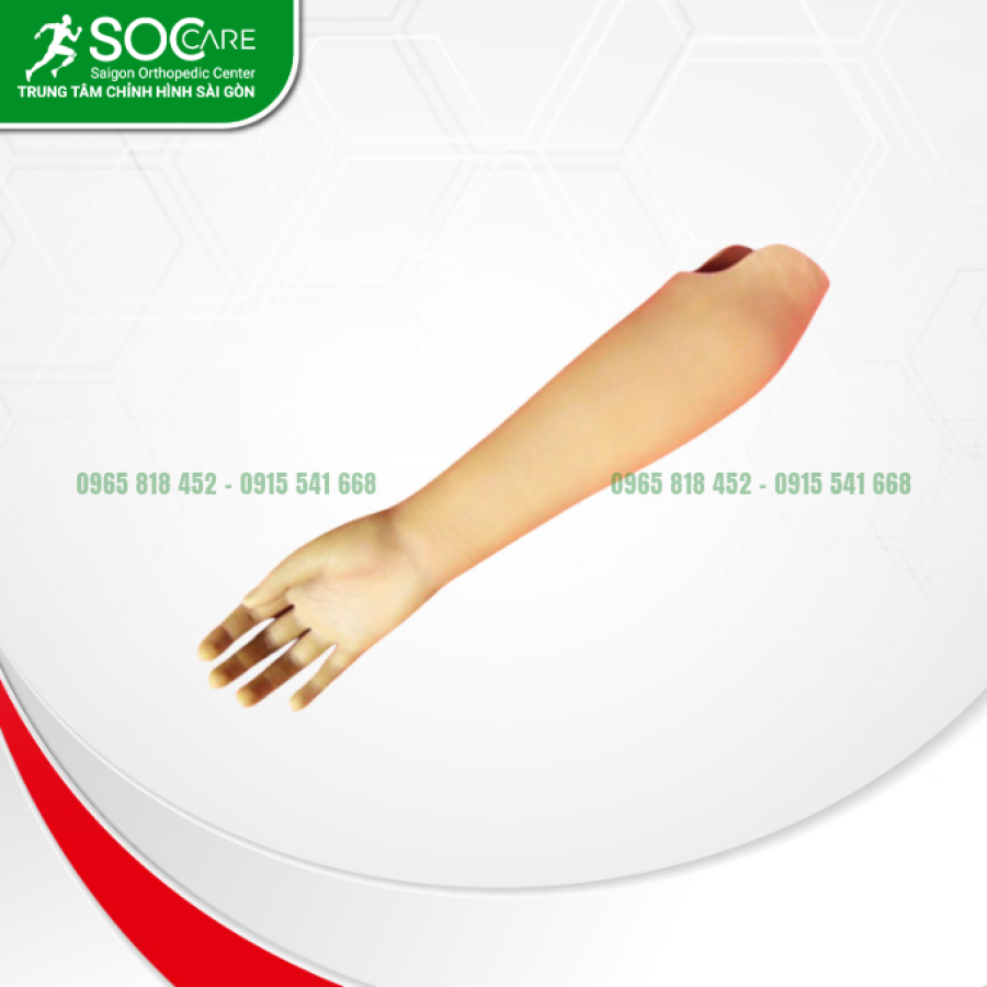 Tay giả dưới khuỷu